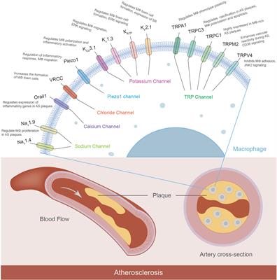 The role of macrophage ion channels in the progression of atherosclerosis